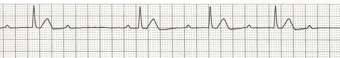 Question 5 Application of EKG in the Clinical Setting PhysicalTherapy ...